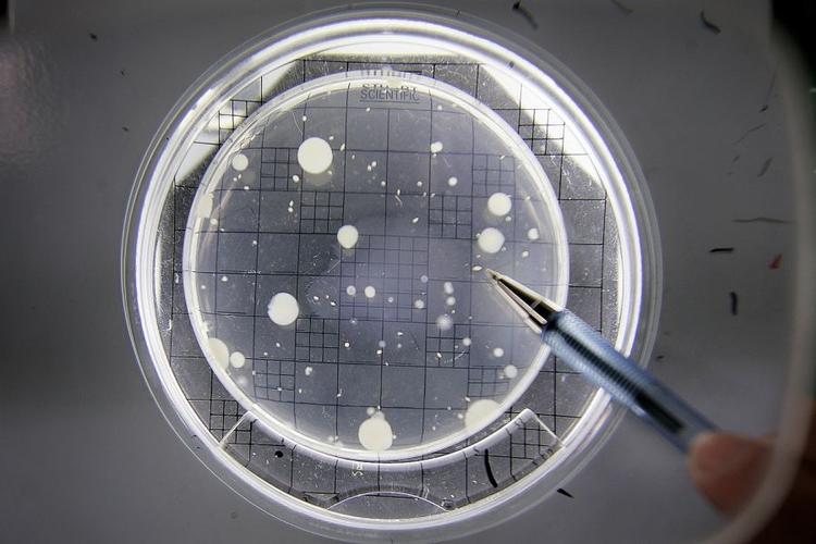 bakterier. Det kan være svært at skelne mellem de forskellige smittefarer. 