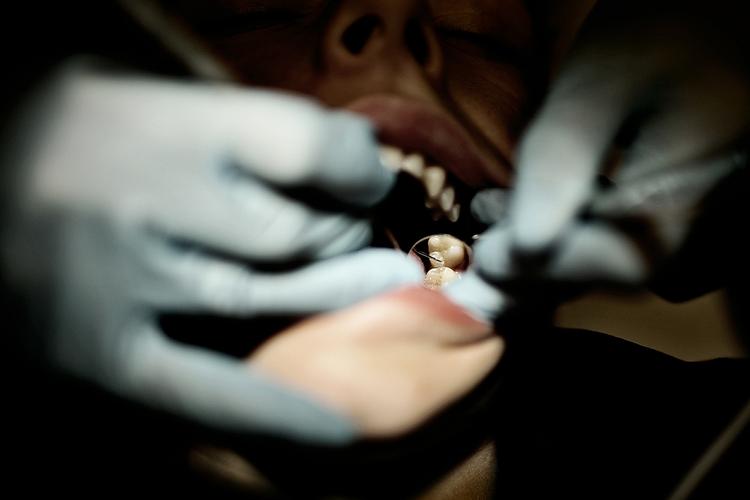 Tandpleje. Tandlæger vil hellere tjene penge end give den bedste behandling, siger forskere og Sundhedsstyrelsen. 