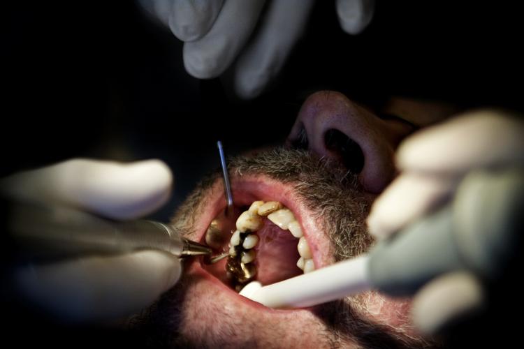 skader. Kræftpatienter, som har fået ødelagt tænderne af behandlinger, har mulighed for at få økonomisk tilskud fra regionerne. Men løfterne gælder ikke, siger Tandlægeforeningen. 