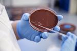 Listeria. Fund af listeria-bakteria på Odense Hospital har forårsaget dødsfald 
