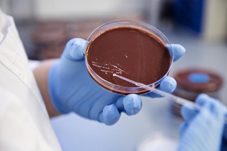 Listeria. Fund af listeria-bakteria på Odense Hospital har forårsaget dødsfald 