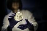 MRSA. Den afdøde person havde ikke kontakt til svinelandbrug. 