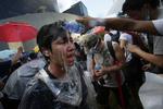Tåregas. En demonstrant i Hongkong behandles efter at have været udsat for tåregas under demonstrationerne i september. 