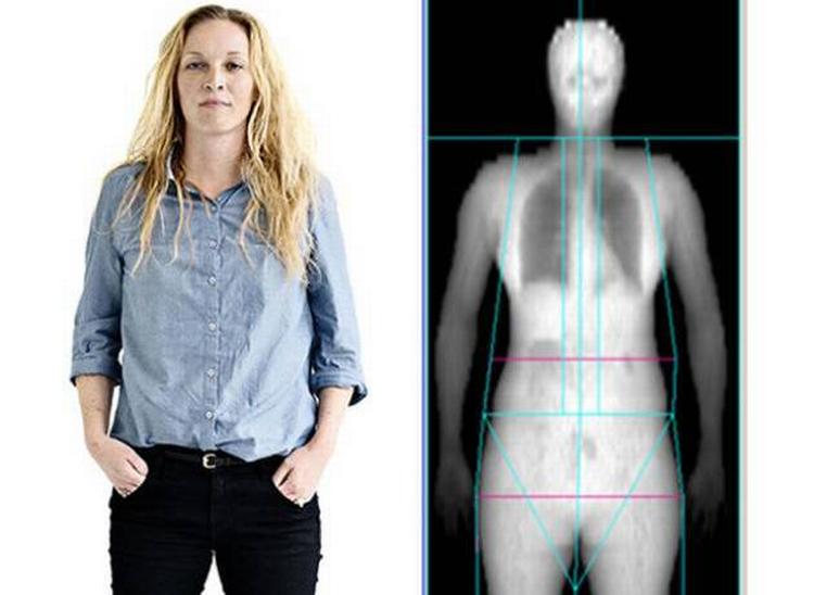 tyndfed. Årets absolut mest populære artikel – ikke blot på Forbrug&amp;Liv, men på hele politiken.dk – handler om 37-årige Louise, der er tyndfed: Hun er slank og bruger størrelse 36 i tøj, men har farligt meget fedt om organerne og er i overhængende fare for at få diabetes. 