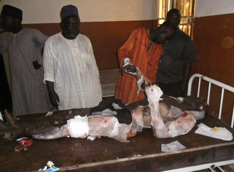 Offer. En mand behandles for sine skader efter at en bilbombe detonerede i det nordlige Nigeria forleden. Her har Boko Haram i længere tid terroriseret lokalbefolkningen med vilkårlige drab, voldtægter, husafbrændinger og bortførelser i kampen for at oprette en islamistisk stat. 