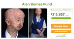 Yndet. Alan Barnes får en håndsrækning fra hele verden, så han kan købe et nyt hus efter at være blevet overfaldet. 