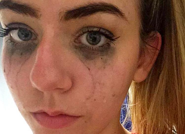 Fan. Sydney Merril lagde et billede af sig selv med udtværet mascara ud på Twitter som reaktion på nyheden om, at Zayn Malik forlader bandet One Direction. 