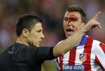 KAMP. Der var kamp så blodet sprøjtede i Madrid-derbyet i Champions League. Her Mandzukic, der fik en albue på næsen. Men det var nu trods manglende mål underholdene alligevel. 