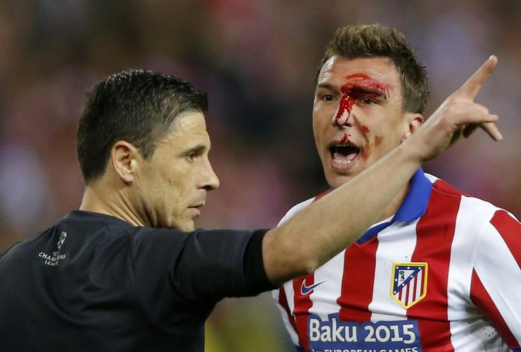 KAMP. Der var kamp så blodet sprøjtede i Madrid-derbyet i Champions League. Her Mandzukic, der fik en albue på næsen. Men det var nu trods manglende mål underholdene alligevel. 