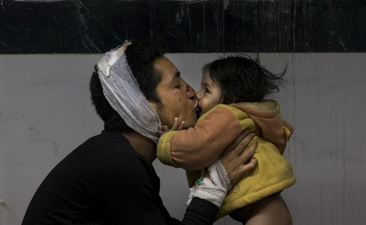 Suresh Parihar leger med sin datter Sandhya på et hospital, i Kathmandu. De er kvæstede, men overlevede jordskælvet. 