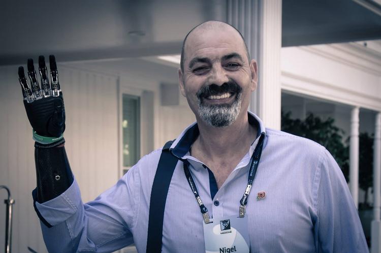 Biohacker. Efter adskillige år med dårlige proteser fik Nigel Ackland endelig sin bioniske hånd, der har gjort ham til menneske igen. 