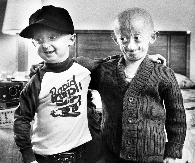 ?Oldinge. I jagten på aldringens gåde studere forskere mennesker, der oplever en accelereret aldring. Her er det to drenge med den sjældne sygdom progeria, ders kyldes en medfødt genfejl. Sygdommen sætter ind i de to første leveår. Børnene ældes, mens de er helt små og har en meget forkortet vetid. Drengene er fotograferet i 1981 på Disneyland Hotel i Anaheim, Californien. 