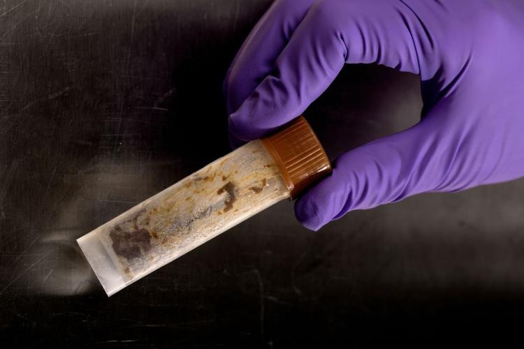 Tarmbakterier. Vi har hver især i gennemsnit 160 hyppigt forekommende bakterietyper i tarmen. 