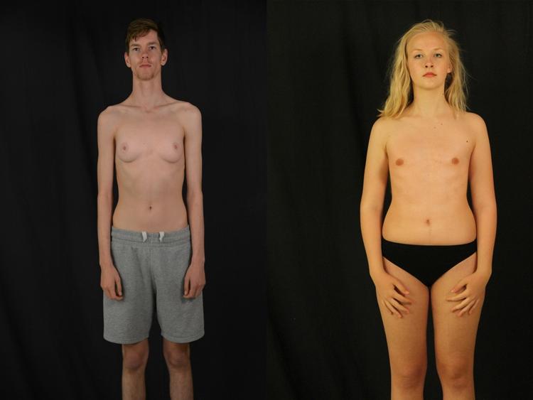 Nej. Selv om det er drengebryster på en pigekrop og den anden vej rundt, så er det stadig ikke okay for Facebook, der har fjernet billederne fra nettet. 