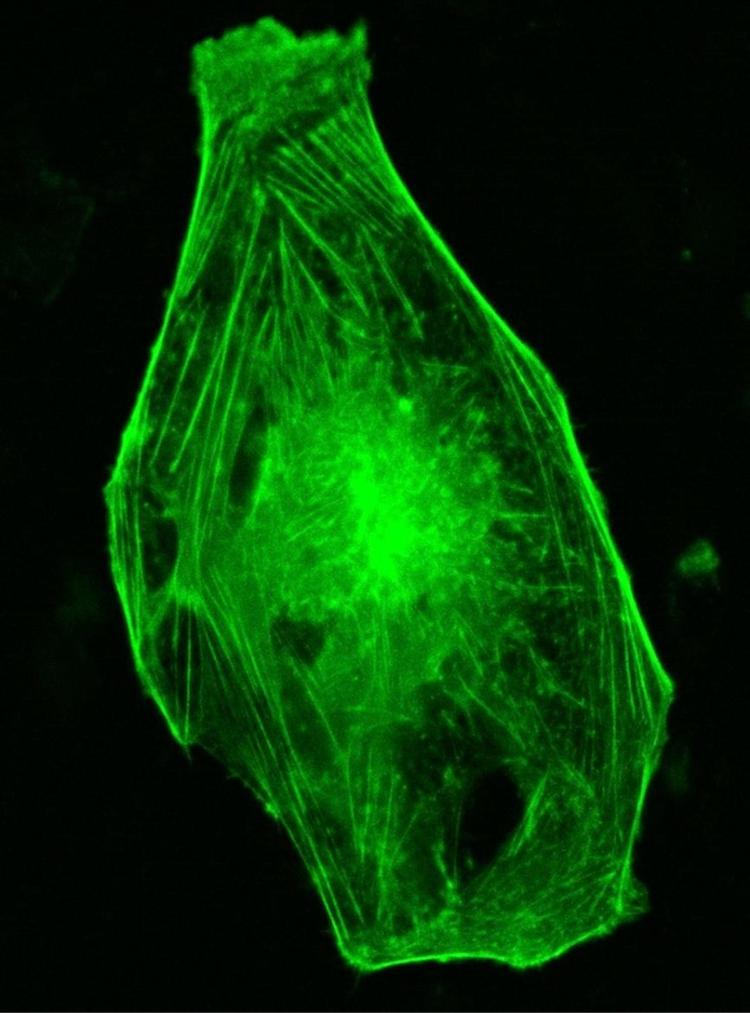Celle. Kræftcelle af den type, der blev sendt til ISS i 2014. 