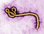 Ebola Eye