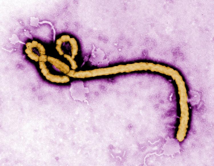 Ebola Eye