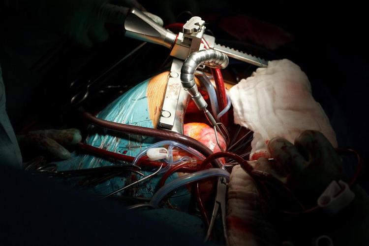 Hjertepatienter venter i hovedstaden længere på udredning end i resten af landet. 