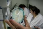 BYRDE. 43 millioner kroner koster det årligt det danske sundhedsvæsen at behandle og forebygge husdyr-MRSA. Det er første gang, der er blevet sat tal på det herhjemme, men 43 millioner er et alt for lavt og groft skøn, mener ekspert. 