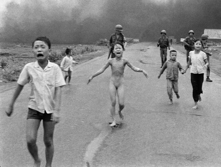 Brændt. Da Kim Phuc nåede helt hen til den amerikanske fotograf Nick Ut, så han, at hendes hud faldt af i fæager. Nu skal laserbehandlinger i USA hjælpe 