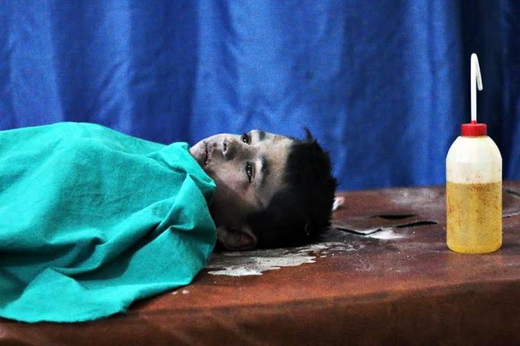 Såret. En dreng er indlagt på et felthospital efter et angreb i Aleppo. 