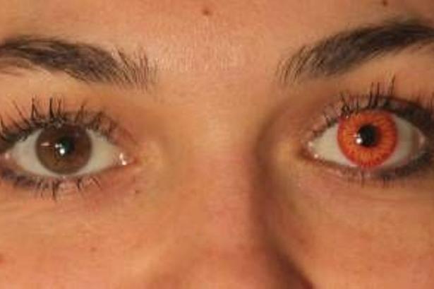 Rødt øje til de brune øjne. 