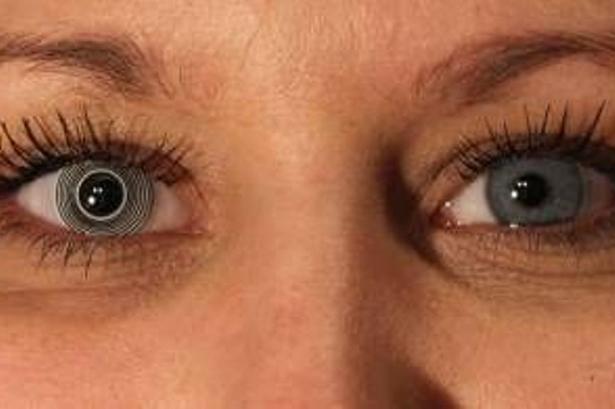 Hvid linse med ringe. 