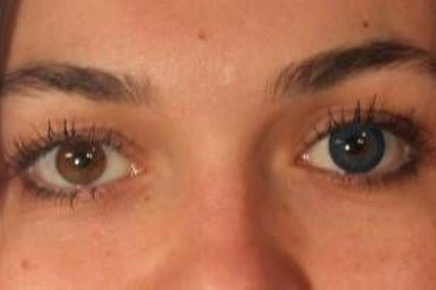 Brune øjne bliver blå. 