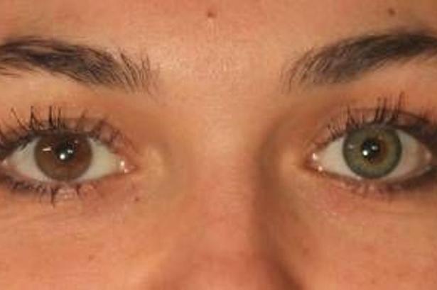 Brune øjne bliver grå. 