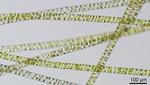 Spirogyra. En af de ferskvands-grønalger, de danske forskere har undersøgt. Forskerne mener, at algens forfader kravlede på land for cirka 500 millioner år siden. Og at den senere kravlede tilbage i vandet. Den sorte streg repræsenterer en afstand på 0,1 millimeter. 
