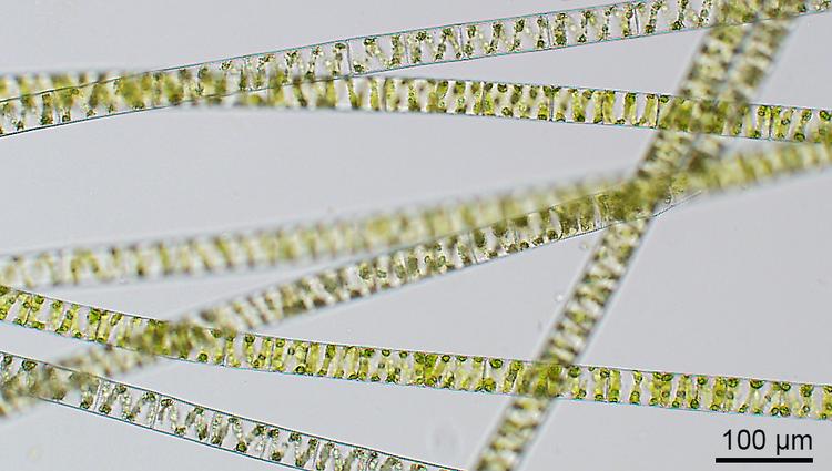 Spirogyra. En af de ferskvands-grønalger, de danske forskere har undersøgt. Forskerne mener, at algens forfader kravlede på land for cirka 500 millioner år siden. Og at den senere kravlede tilbage i vandet. Den sorte streg repræsenterer en afstand på 0,1 millimeter. 