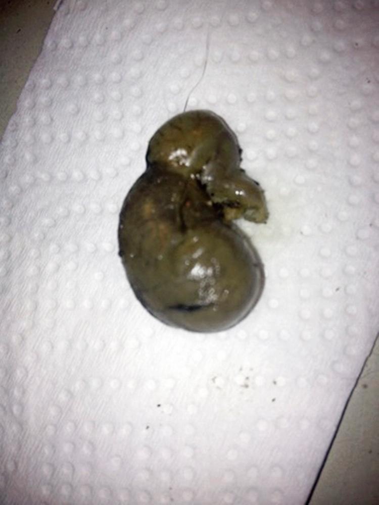 Gåde. En læser spurgte i lørdags, hvad dette er. En musemavesæk efterladt af en kat, lød svaret, som beskræftes af en anden læser i denne uge. Privatfoto 