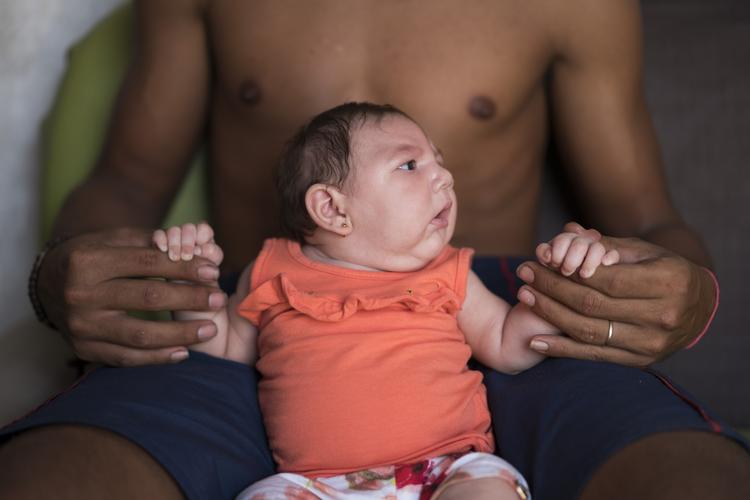 inficeret. Dejailson Arruda holder sin datter Luiza i familiens hus i Santa Cruz do Capibaribe i Brasilien. Luiza blev født, efter at hendes mor var blevet inficeret af zikavirus efter et myggestik. 