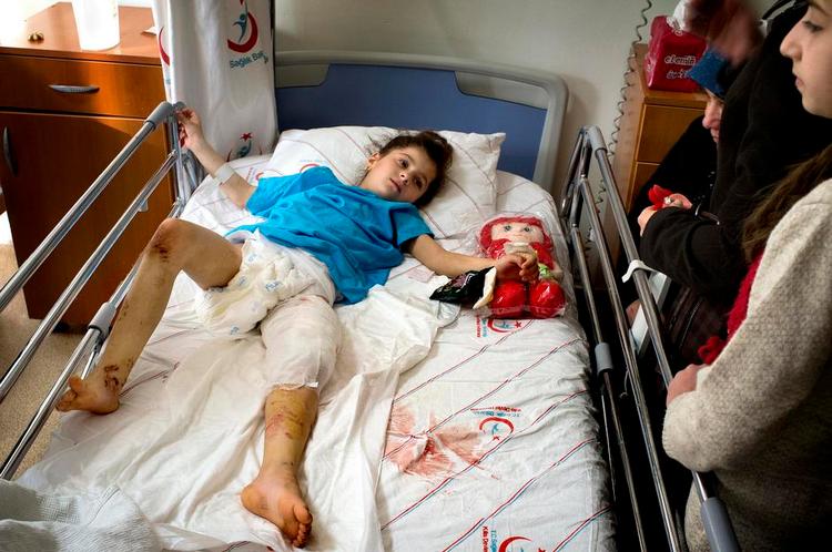 Såret. 7-årige Raghan blev reddet ud af ruinerne, efter fly bombede familien Khatibs hjem i Layramon i den nordvestlige del af Aleppo. 