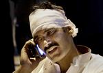 Terror. En såret mand taler i mobiltelefon på et hospital i Lahore, efter et bombeangreb mod en park i byen efterlød over 70 døde. Halvdelen er børn. 