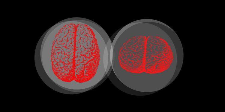 FORSKEL. Når menneskehjernen er presset, fravælger den grammatiske elementer i en sætning, så 'Peter har købt en cykel' under tidspres vil blive læst som 'Peter køb cykel'. Det viser ny dansk forskning. Opdagelsen kan være med til at forbedre den måde, man behandler folk med sprogrelaterede hjerneskader på. Illustration: Tomas Østergren 