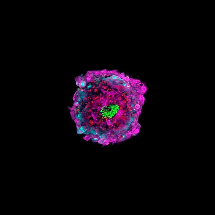 Livsspire. Her er det kugleformede 13 dage gamle menneskefoster, som det er lykkedes forskere at dyrke i en petriskål. Fosteret er blevet favelagt af fluorescerende antistoffer. 