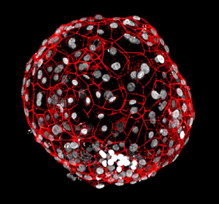 Liv. Her er det kugleformede menneskefoster, som det er lykkedes at dyrke i en petriskål i hele 13 dage. Fosteret er blevet farvelagt med antistoffer. 