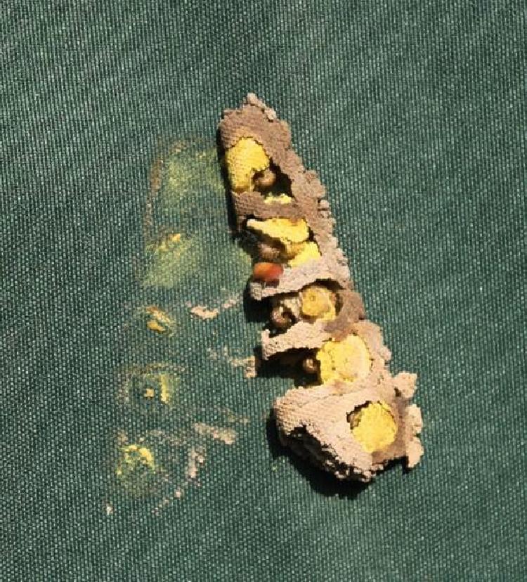 bevis. En læser har nu løst sidste uge mysterium ved at sende dette billede af sin parasol. 