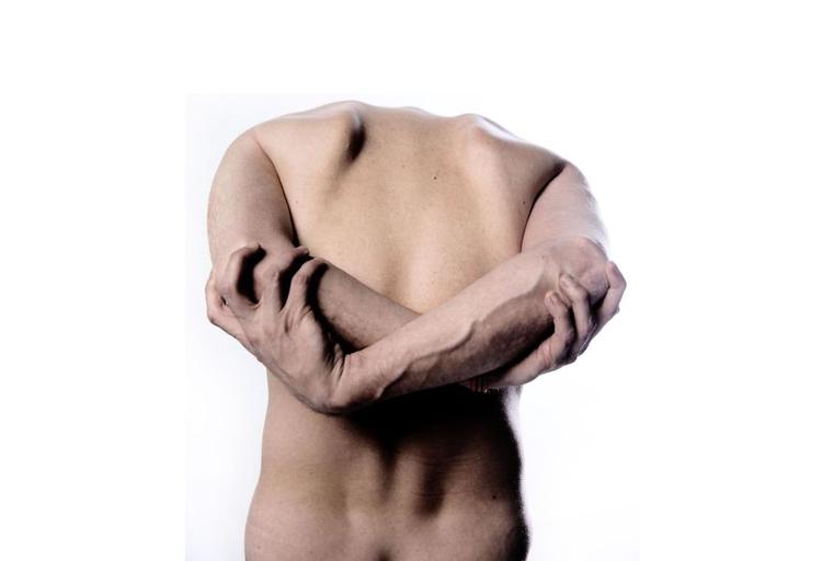 Skulderskade. Siden sommeren 2013 har håndværkeren Svend Møller ventet på Arbejdsskadestyrelsens endelige vurdering af, hvor stor en del af arbejdsevnen han har tabt på sin skulderskade 