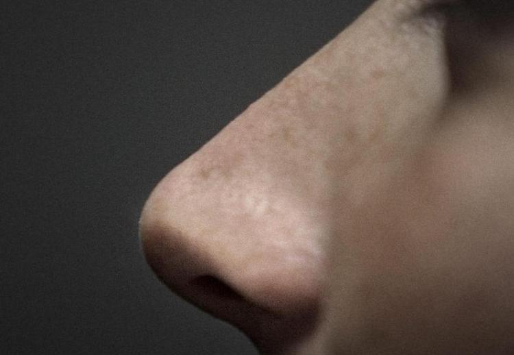 Beskyttelse. 5-10 procent har den bakterie boende i næsen, som ifølge de internationale forskere udgør en slags naturlig beskyttelse mod stafylokok-infektioner.Foto: Miriam Dalsgaard. 