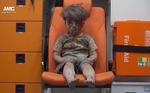 BLIK. Den syriske storby Aleppo har været opdelt mellem oprørerne og Assad-regimet i de sidste fire år. Begge bydele er nu belejret og centrum i en ekstremt hård kamp, hvor begge parter er blevet beskyldt for at begå massive krigsforbrydelser. I denne uge brød billedet – og videoen - af den 5-årige Omran Daqnessh, der blev reddet fra ruinerne af en bygning i den østlige del af byen og med et tomt blik sidder i en ambulancestol gennem apatien og blev et symbol på Aleppo og lokalbefolkningens lidelser. For reelt er Omran en af de heldige – eftersom han overlevede bombeangrebet. 