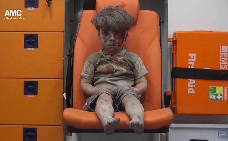 BLIK. Den syriske storby Aleppo har været opdelt mellem oprørerne og Assad-regimet i de sidste fire år. Begge bydele er nu belejret og centrum i en ekstremt hård kamp, hvor begge parter er blevet beskyldt for at begå massive krigsforbrydelser. I denne uge brød billedet – og videoen - af den 5-årige Omran Daqnessh, der blev reddet fra ruinerne af en bygning i den østlige del af byen og med et tomt blik sidder i en ambulancestol gennem apatien og blev et symbol på Aleppo og lokalbefolkningens lidelser. For reelt er Omran en af de heldige – eftersom han overlevede bombeangrebet. 
