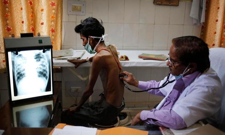 Dødsensfarlig. En indisk læge undersøger en patient med tuberkulose. Indien har ifølge WHO verdens største forekomst af tuberkulose med 300.000 dødsofre hvert år. Fotos: Rajesh Kumar Singh og dr. Volker Brinkmann 