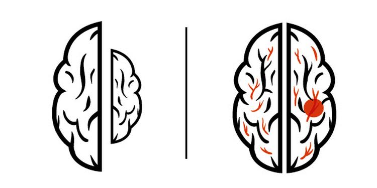 Illustration: Mads Pedersen. 