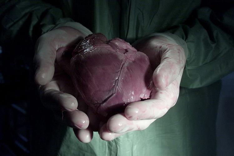 Et flertal i Folketinget vil have danskerne til aktivt at tage stilling til organdonation. Her er det et hjerte, der er klar til organdonation. Arkivfoto. Lars Skaaning/POLFOTO