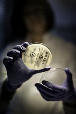 FORBUD. Jeg tror godt, at det her kan resultere i, at man begrænser brugen af antibiotikatypen colistin i landbruget, og at det muligvis ender med et forbud. For fra et menneskeligt synspunkt er det bekymrende, at man bruger colistin til dyr med den nye viden, vi har, lyder det fra en overlæge i Statens Serum Institut. 