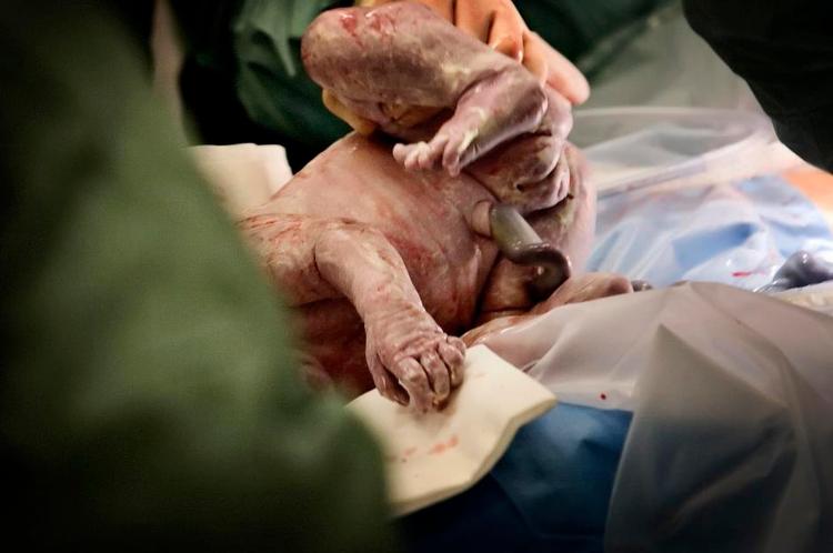 Travlhed. Jordemødre og læger på Herlev Hospital udtrykte i dag sympati med Morten Hedegaards afgang fra føde- afdelingen på Rigshospitalet. Herlev er også presset, så det »ofte svarer til en overlevelseskamp«, siger overlæge Henrik Nyholm. Arkivfoto: Joachim Adrian 