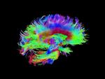 Den nye forskning viser, at lsd giver hjernen mere energi, og det psykedeliske stof kan omdirigere trafikken, så de elektriske signaler løber gennem nye hjerneforbindelser, som hjernen ikke bruger i upåvirket tilstand. 