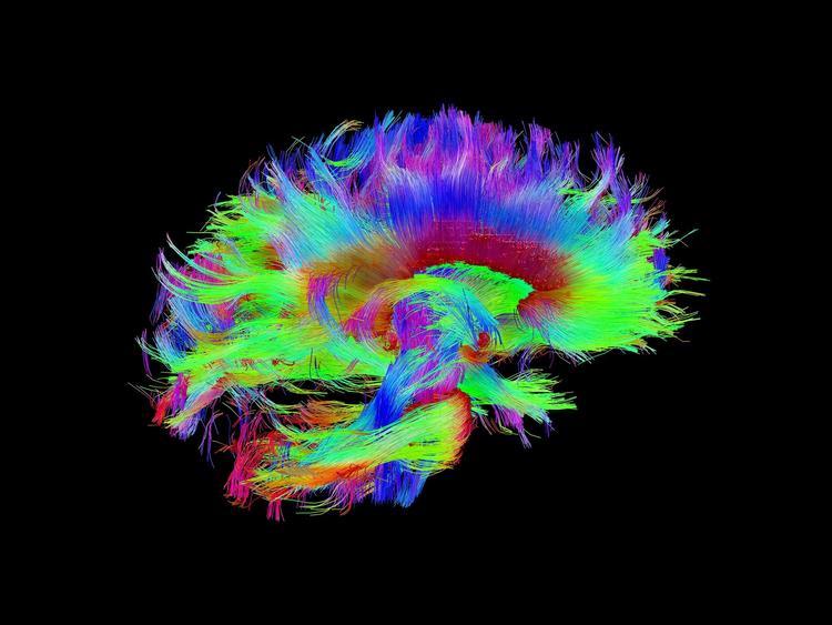 Den nye forskning viser, at lsd giver hjernen mere energi, og det psykedeliske stof kan omdirigere trafikken, så de elektriske signaler løber gennem nye hjerneforbindelser, som hjernen ikke bruger i upåvirket tilstand. 